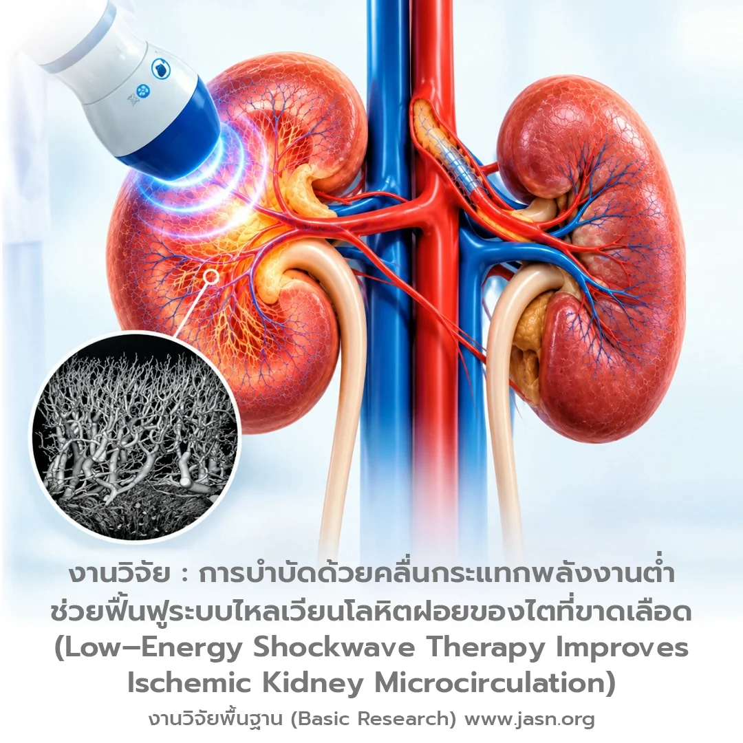การบำบัดด้วยคลื่นกระแทกพลังงานต่ำช่วยฟื้นฟูระบบไหลเวียนโลหิตฝอยของไตที่ขาดเลือด (Low–Energy Shockwave Therapy Improves Ischemic Kidney Microcirculation)